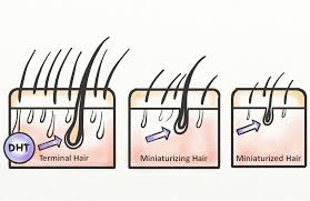 Most of the time if. Green Tea For Hair Growth Results Benefits Uses Hairguard