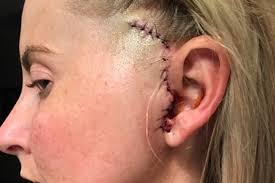 Fundraiser for Jules Nelson by Jules Nelson : Life for Jules