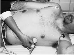 The vertical gradient in the lateral decubitus position is less than that in the upright position (fig. The Echocardiographic Examination Thoracic Key