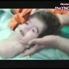 Tapi elizabeth adalah pemuja kesempurnaan dan kecantikan dan dia akan melakukan apa saja demi mempertahankan kecantikannya. Bayi Ini Dilahirkan Dengan Dua Kepala Pelik Tapi Benar