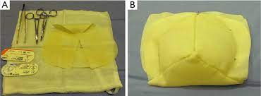 Toni braxton — why won't you love me 04:41. A Acellular Dermal Matrix Adm Available As A Prepared Template To Download Scientific Diagram
