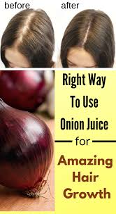 Right Way To Use Onion Juice For Amazing Hair Growth Hairgrowth Haircare Haircaretips Diyremedies Hairgoals Diyhair Naturalhair Onions Cheveux