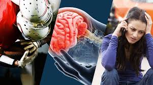 Image result for Brain Contusion