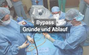 A deflected route usually around a town. Bypass Definition Grunde Ablauf Der Operation Praktischarzt