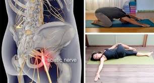 Nowadays, this is one of the most common medical issue that people experience. Get Rid Of Sciatica And Lower Back Pain With Simple Yoga Poses Awaken