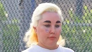 Amanda Bynes unveils latest body modification after getting lip fillers and dropping almost 30lbs on Ozempic