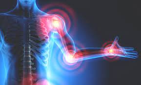 Was Ist Der Unterschied Zwischen Arthrose Arthritis Und Rheuma