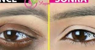 7 Gecede Bu Kahve Serumu Ile Goz Cevresindeki Koyu Cemberler Sonsuza Kadar Kaybolacak Serum Cilt Bakim Urunleri Cilt Bakimi