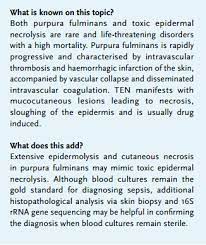 94.4% (n=17) of ceprotin treatments were rated as effective in treating purpura fulminans (pf) compared to 52.4% (n=11) of the historical controls 1,2. Article Purpura Fulminans Mimicking Toxic Epidermal Necrolysis Additional Value Of 16s Rrna Sequencing And Skin Biopsy Full Text May 2017 Njm