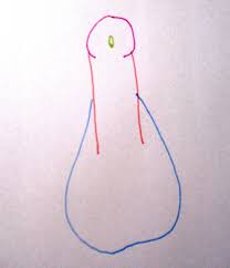 Intersex bodies are treated as emergencies and bodies in need of fixing. The Intersex Roadshow