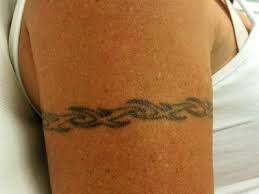 Get picosecond tattoo removal by registered medical experts at an affordable rate! Tattoo Removal Newcastle Skiinsure Laser Clinics