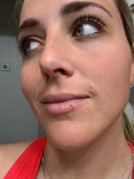 For those asking how my lip is doing after the angry hen got me… thankfully  healing well😅 She definitely taught me a lesson lol