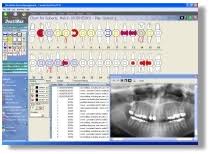 Dental Software Programs Free Demo