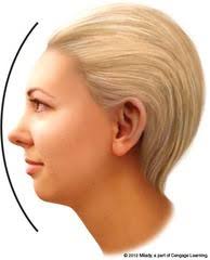 Convex Profile Receding Forehead Chin Style Curls Or Bangs Over The Forehead And Keep Style Close To The Head Hair Designs How To Style Bangs Face Profile