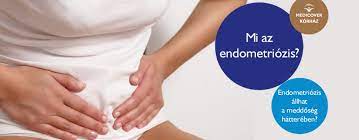 Endometriozis has the lowest google pagerank and bad results in terms of yandex topical citation index. Endometriozis Allhat A Meddoseg Hattereben