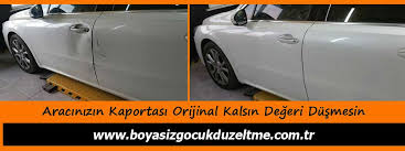 Boyasiz Gocuk Duzeltme Fiyati 2019