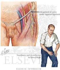 Maybe you would like to learn more about one of these? Lateral Femoral Cutaneous Nerve