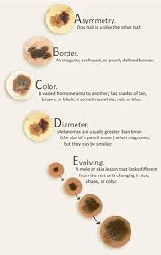Skin dermatitis is an umbrella term describing inflammation of the skin. Moondust Cosmetics Did You Get A Lot Of Freckles Or Spots This Summer They Might Be Worth Getting Checked Out Preventing Skin Cancer Is So So Easy By Having Routine Spot Checks
