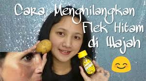 Cara menghilangkan flek hitam di wajah dengan skin care yang tepat. 26 Cara Memutihkan Wajah Secara Alami Dan Cepat
