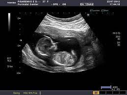 We provide beautiful photos of your newest addition while giving expectant parents a wonderful bonding experience with their unborn child. 4 Weeks Pregnant Sonogram Novocom Top