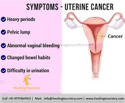 A comprehensive guide to womb cancer. Pin On 2020