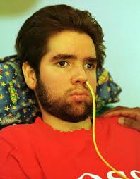 That special "one": The boy who inspired Lorenzo's Oil