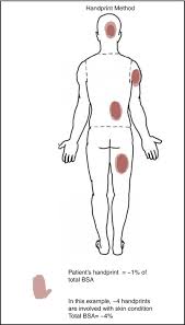 Outcome Measures In Psoriasis And Atopic Eczema Springerlink