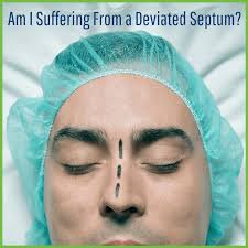 Some people are born with a deviated septum. Deviated Septum Suffering From Breathing Through Your Nose