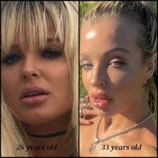 The left side of this photo at the age of 26- I had just stayed up all  night partying 'til 4am, slept 3 hours and then went to the beach with my