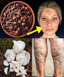 My 56-year-old mother could NOT walk because of the PAIN in her bone and  knee joints and I take this only polite members will say thank you for the  recipe The recipe