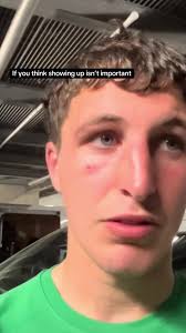 Meath Fans Empty Stadium Early in SEMI FINAL Shock