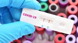 Biaya Rapid Test Maksimal Rp 150 Ribu Dpr Gunakan Produk Lokal Lebih Murah