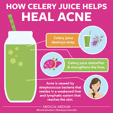 How Celery Juice Helps Heal Acne Medical Medium Blog Read How Celery Juice Helps Heal Acne Now At Www M In 2020 Celery Juice Benefits Juice For Skin Medical Medium