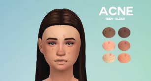 Boredsimblr Acne Now Even Your Sims Won T Have Fantayzia Maxis Match Sims 4 Sims Sims 4 Cc Skin