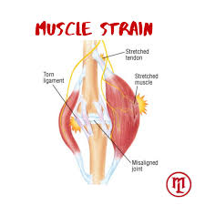 Initial treatments for low back muscle strain. How To Heal Muscle Strains Lee S Fitness Unlimited