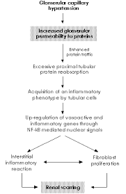 Image result for Proteinuria Causes