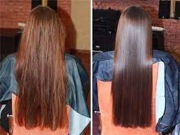 فوائد و أضرار و أنواع الفيلر للشعر وما هي تكلفة hair filler موقع ر كن