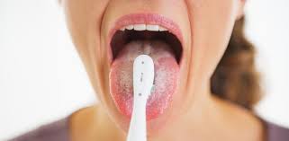 Alternativ, visul poate insemna ca unele persoane va vorbesc pe la daca visati ca aveti o buba mare si rosie pe fata inseamna ca va merge bine si aveti o stare de sanatate foarte buna. Limba Crapata Cauze Si Tratament Sfaturimedicale Ro