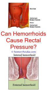 Do Hemorrhoids Leak Cure For Hemorrhoids Bleeding Hemorrhoids Hemorrhoid Remedies
