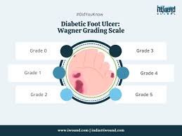 Image result for Wagner Ulcer Classification