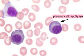 الخلية البلازمية plasma cell stud earrings plasma pill