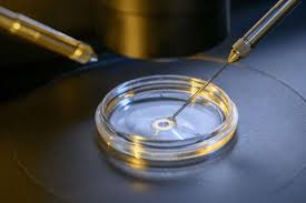 Fertilizare in vitro pret 2018. Fertilizare In Vitro GratuitÄ 2017 Clinicile Incluse Ce Cupluri Sunt Acceptate Totul Despre Mame