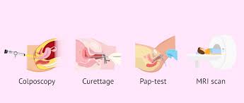 If cervical cancer is suspected, your doctor is likely to start with a thorough examination of your cervix. Diagnostic Tests For Cervical Cancer