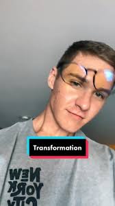 Cole Anthony Hair Balding