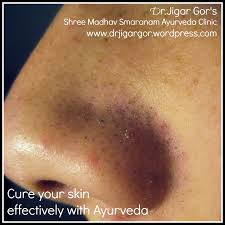 We did not find results for: Ayurveda Skin Care Dr Jigar Gor S