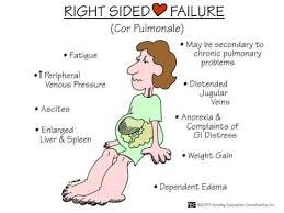 Image result for Right Heart Failure