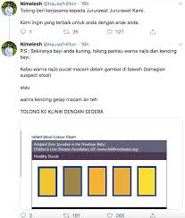 Jika berat badannya naik, bayi sihat dan tidak meragam, kencing dengan banyak dan tiada. Kalaulah Jururawat Tak Melawat Hari Itu Entah Apa Jadi Kepada Bayi