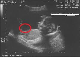 Heartbee Aku Tulis Apa Yang Aku Mahu Confirm Dapat Anak Lelaki Bila