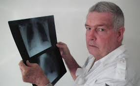 Death sentence was x-ray blunder