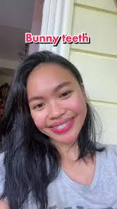 Ayan na! #fypシ #fyp #FYP #teethbraces #braces